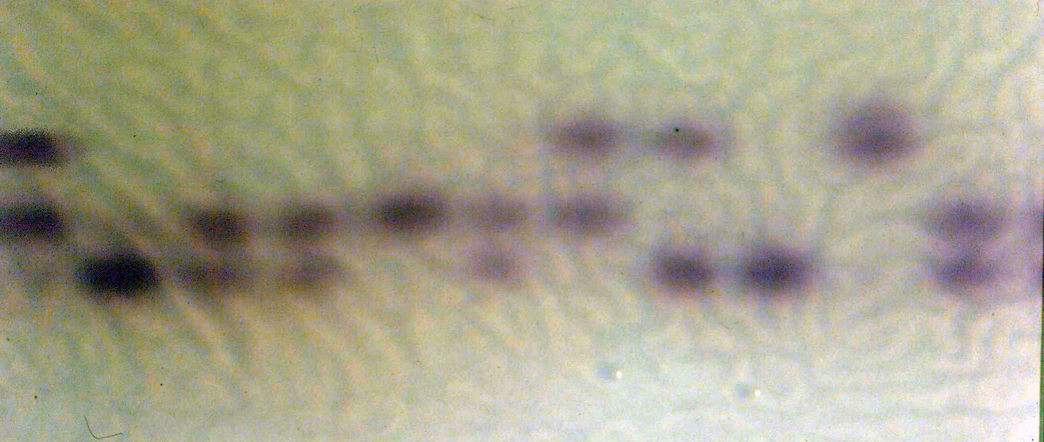 Opdh gel